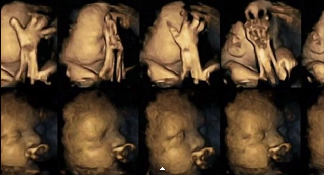 Amazing scans reveal what smoking does to an unborn baby