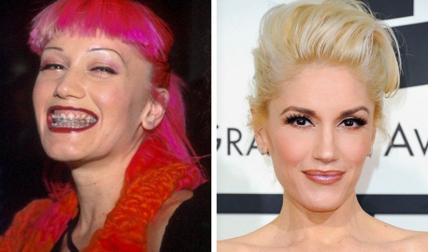 Now And Then: Celebrity Photos From The 90s Vs. Today