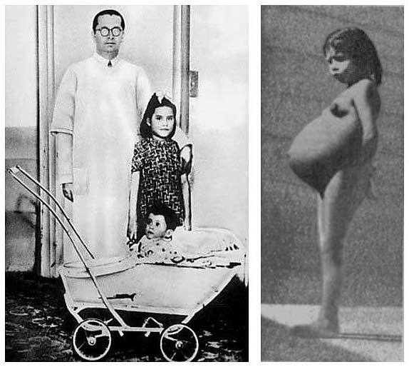 The world’s youngest mothers in medical history