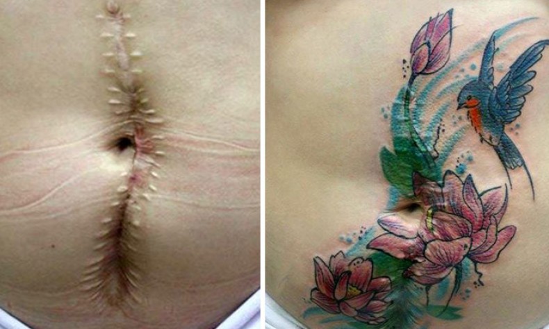 23 obvious candidate for tattoo removal (photos)