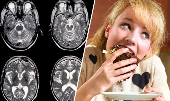 Can you TRAIN your brain to quit sugar? Health hack to stop your sweet tooth