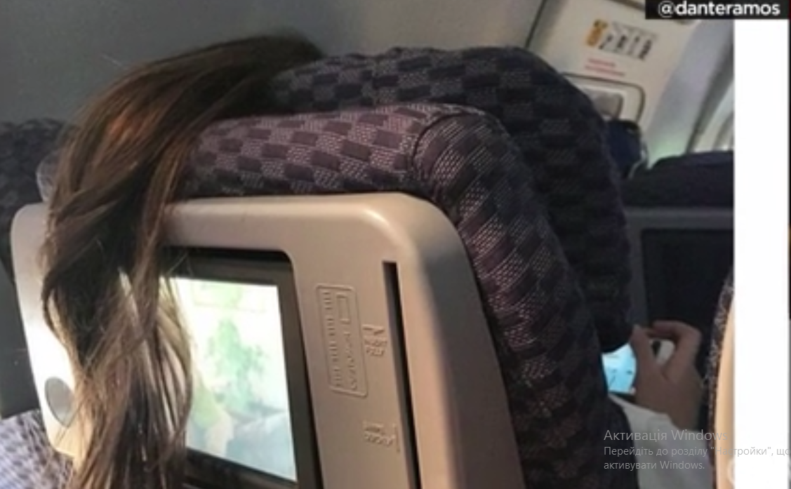 Eww! Airplane ponytail incident goes viral