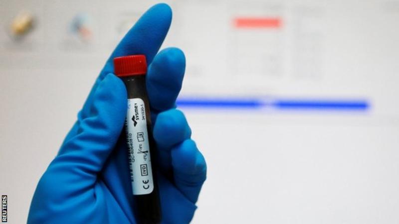 Russia doping: New Wada report reveals obstructions to testing