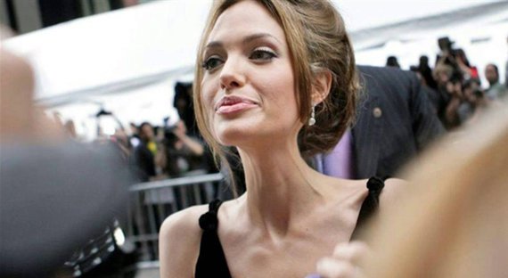 «Умирающая» Анджелина Джоли шокировала всех, засветив грудь на заседании ООН
