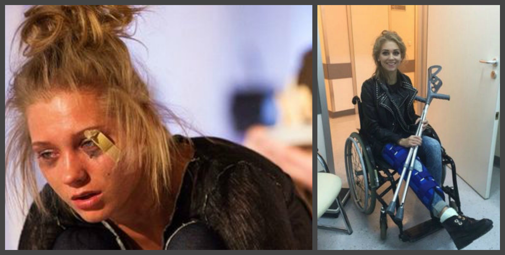 Шок! Кристина Асмус прикована к инвалидному креслу!