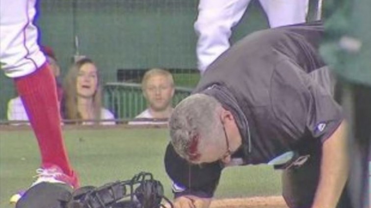 TERRIBLE: MLB Umpire Covered In Blood (VIDEO)