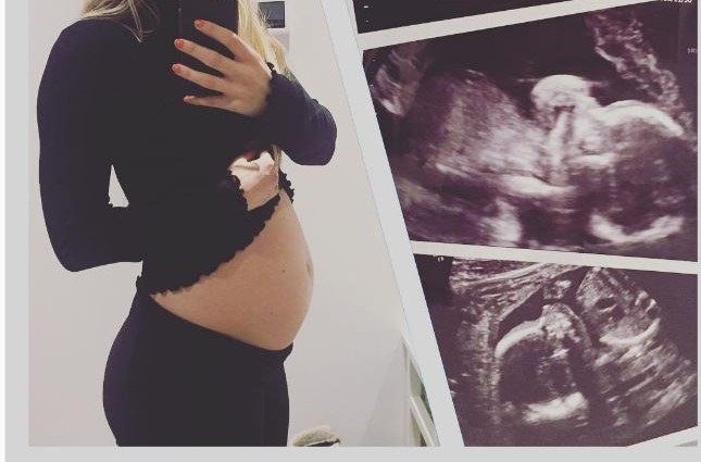 Congrats! Another UFC champ Expecting A First Child