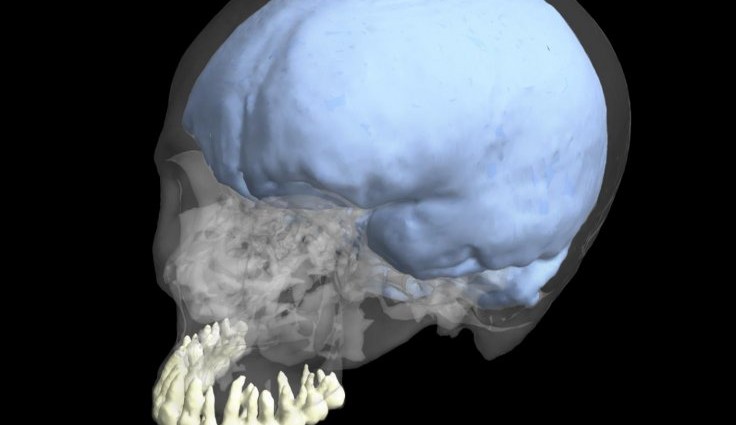 Myth buster: Our big brains and small teeth did not evolve at the same time