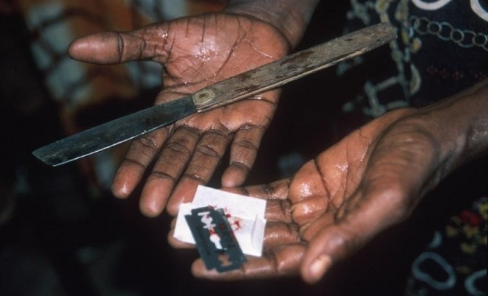 Женское обрезание: ужас, с которым надо бороться