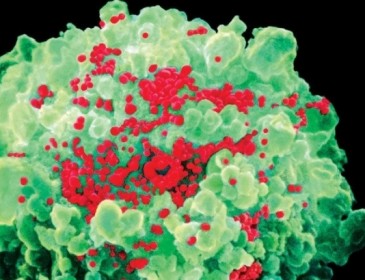 Новая вакцина от ВИЧ помогла первым пациентам