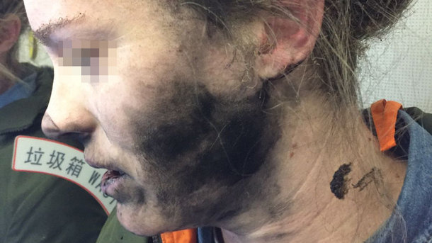 Беспроводные наушники взорвались в ухе девушки на борту самолета
