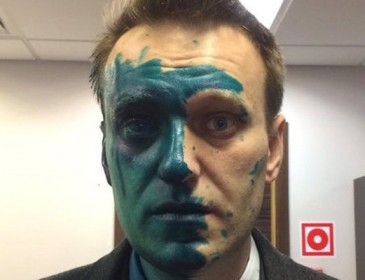 Нападение с зеленкой в Москве: Навальный получил химический ожог глаза