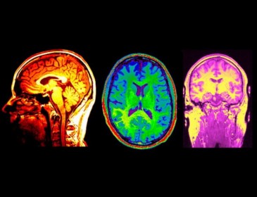 Учёные обнаружили связь между повреждениями в мозге и властью